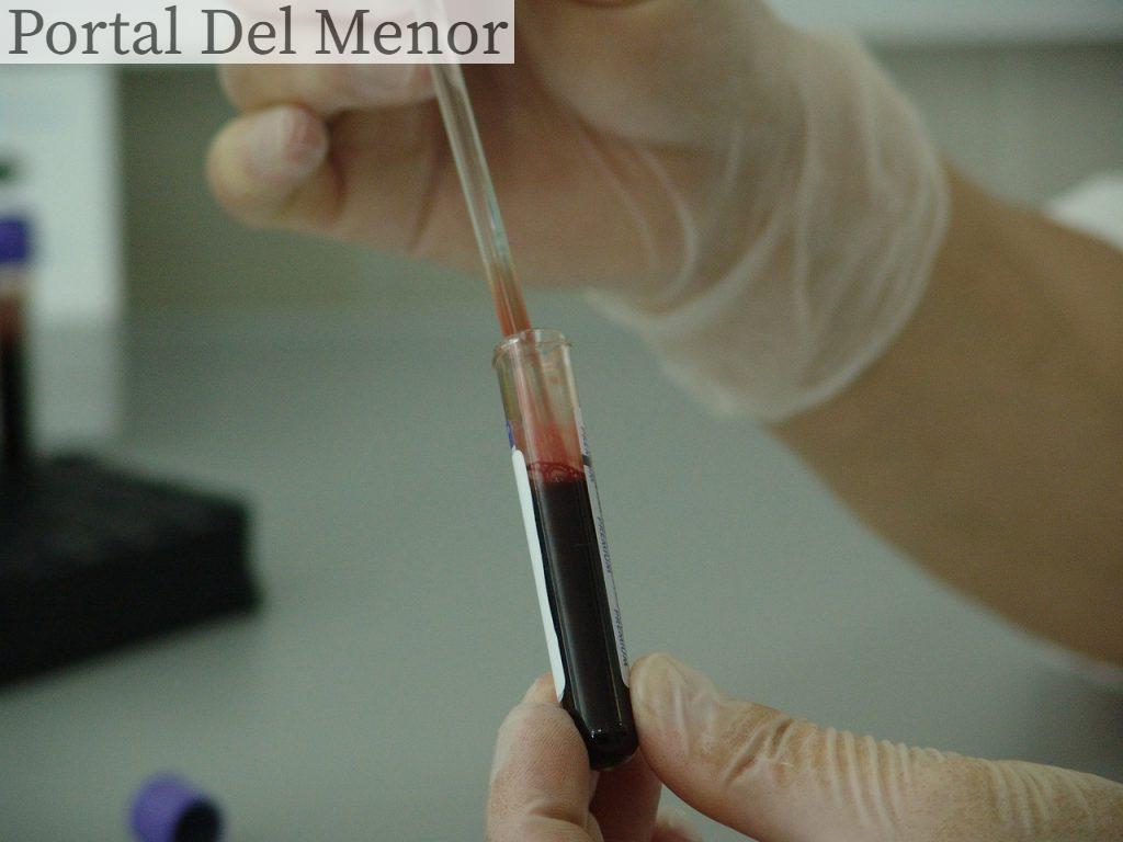 vial analisis